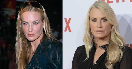 A picture of Daryl Hannah before (left) and after (right).